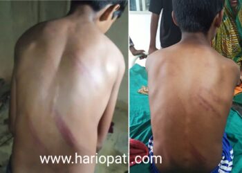 सिरहामा प्रिन्सिपलकाे कुटाइबाट विद्यार्थी घाइते