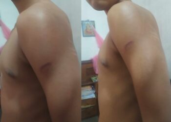 गृहकार्य पूरा नगरेको भन्दै उर्लाबारीमा विद्यार्थीमाथि निर्घात कुटपिट